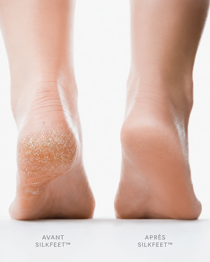SilkFeet™ — La Râpe Électrique Pro Anti-Callosités