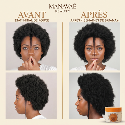 Batana+® : Accélérateur de Repousse